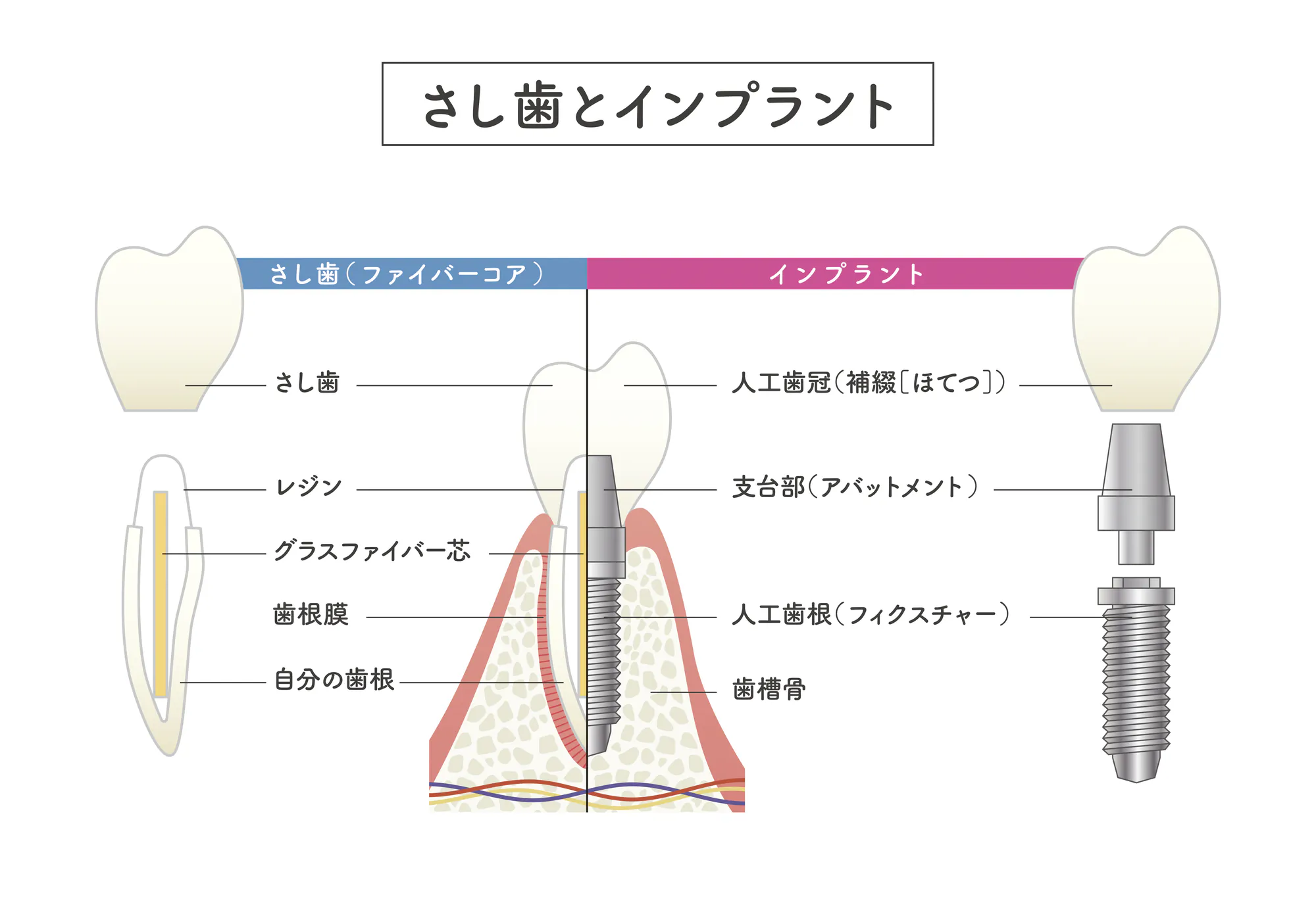 久里浜の歯医者、久里浜グリーン歯科の自家歯牙移植