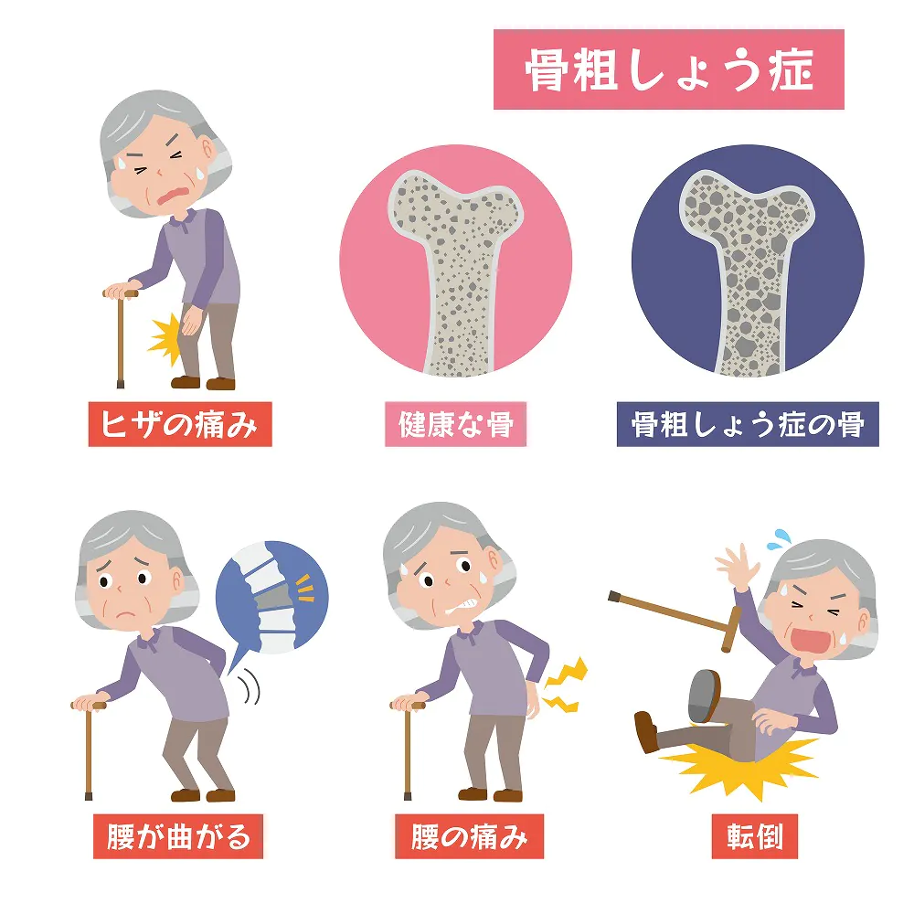 久里浜の歯医者、久里浜グリーン歯科の歯周病と骨粗しょう症